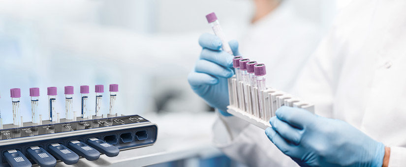 Ellume announces high-performance test for active COVID-19 infection